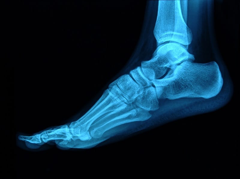 foot radiography
