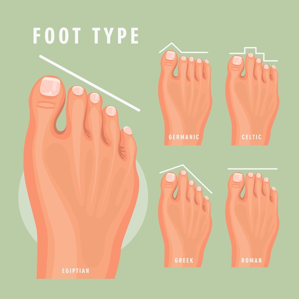 Types de pieds