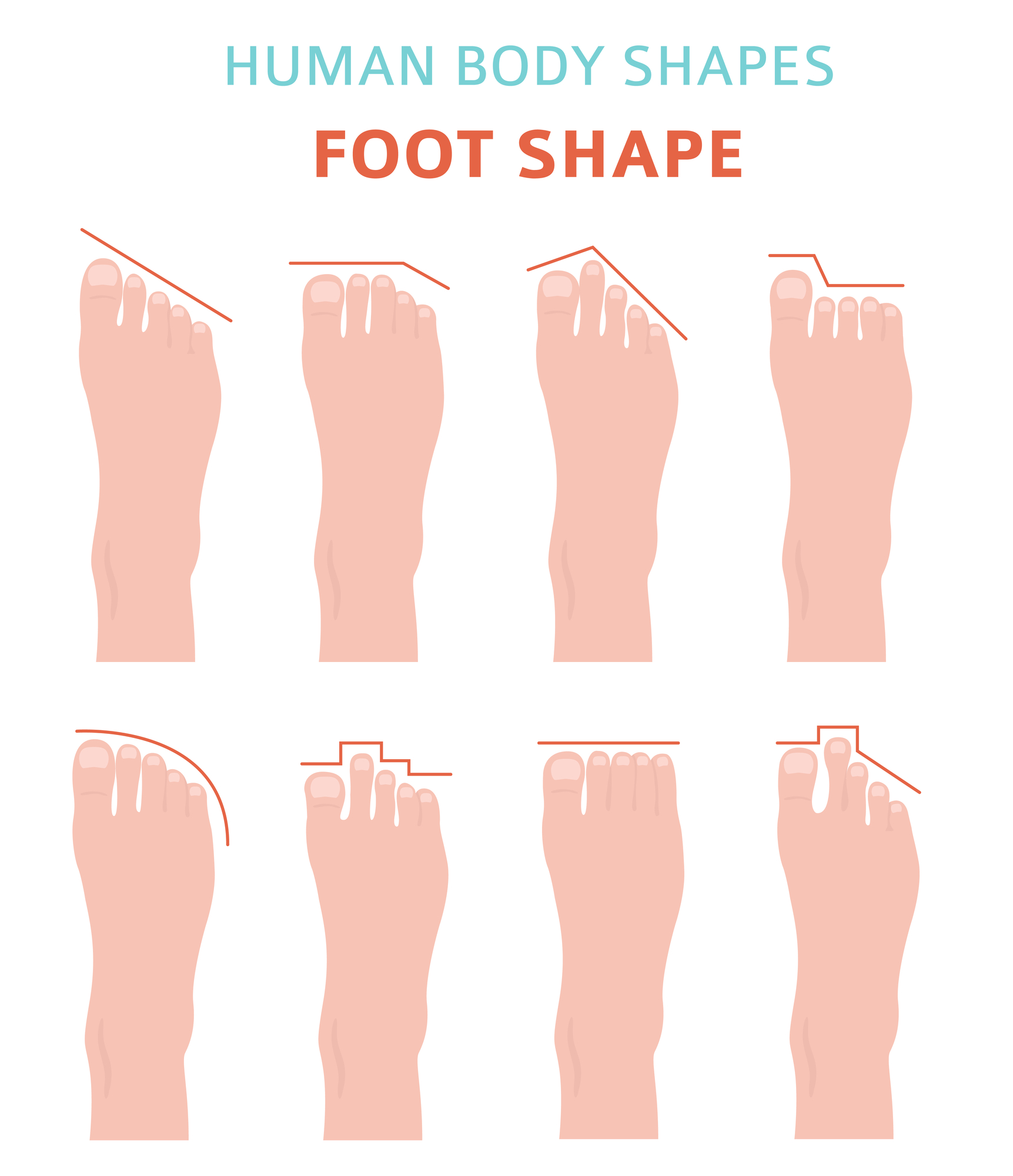 types de pieds