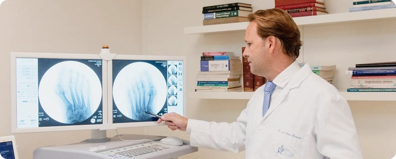 Doctor revisando radiografías de cirugía de juanetes en Clínica San Román