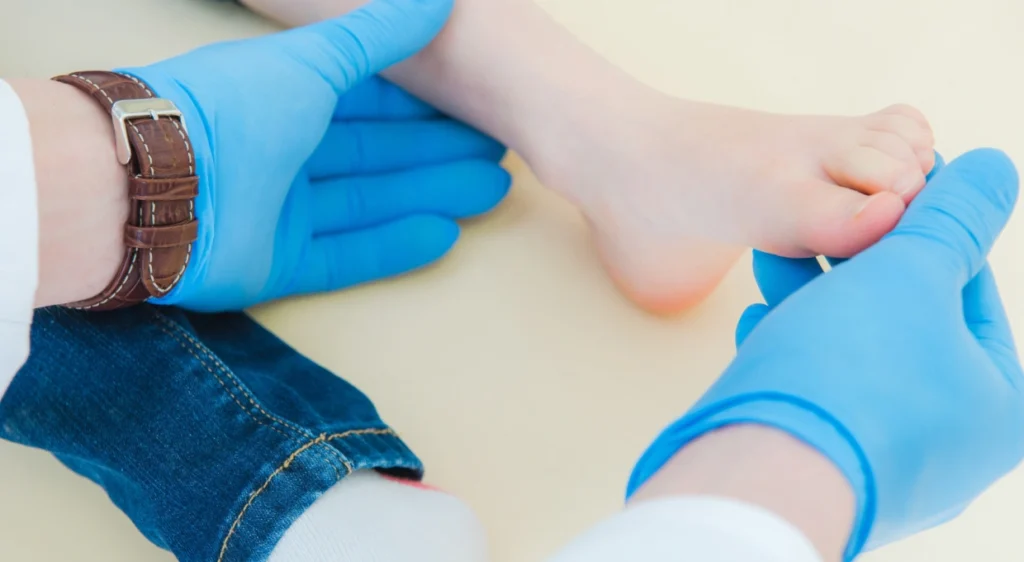 Malformations du pied chez l’enfant : diagnostic et traitement