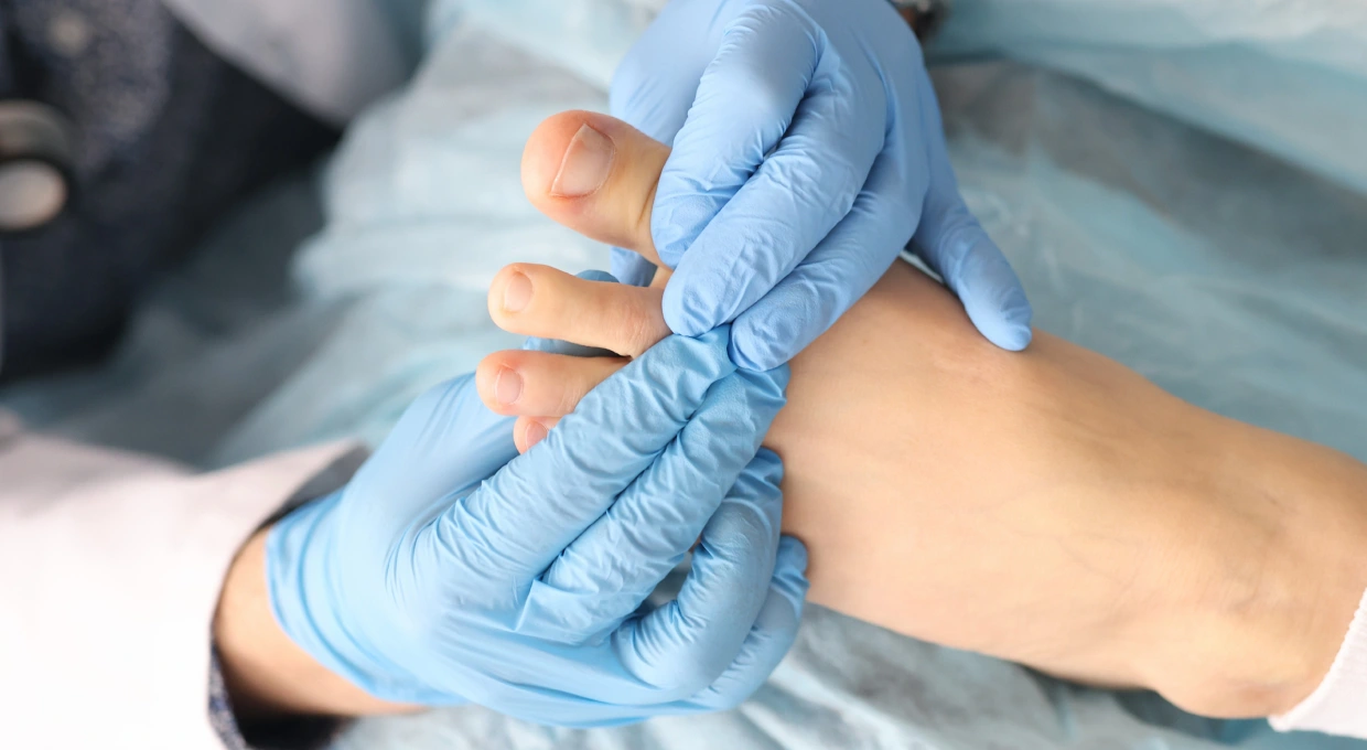 guide de la chirurgie percutanée-2 guide de la chirurgie percutanée-2