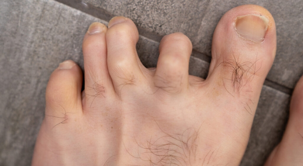 genesung-real-chirurgie-finger-in-den-handschuhen-herausgehen