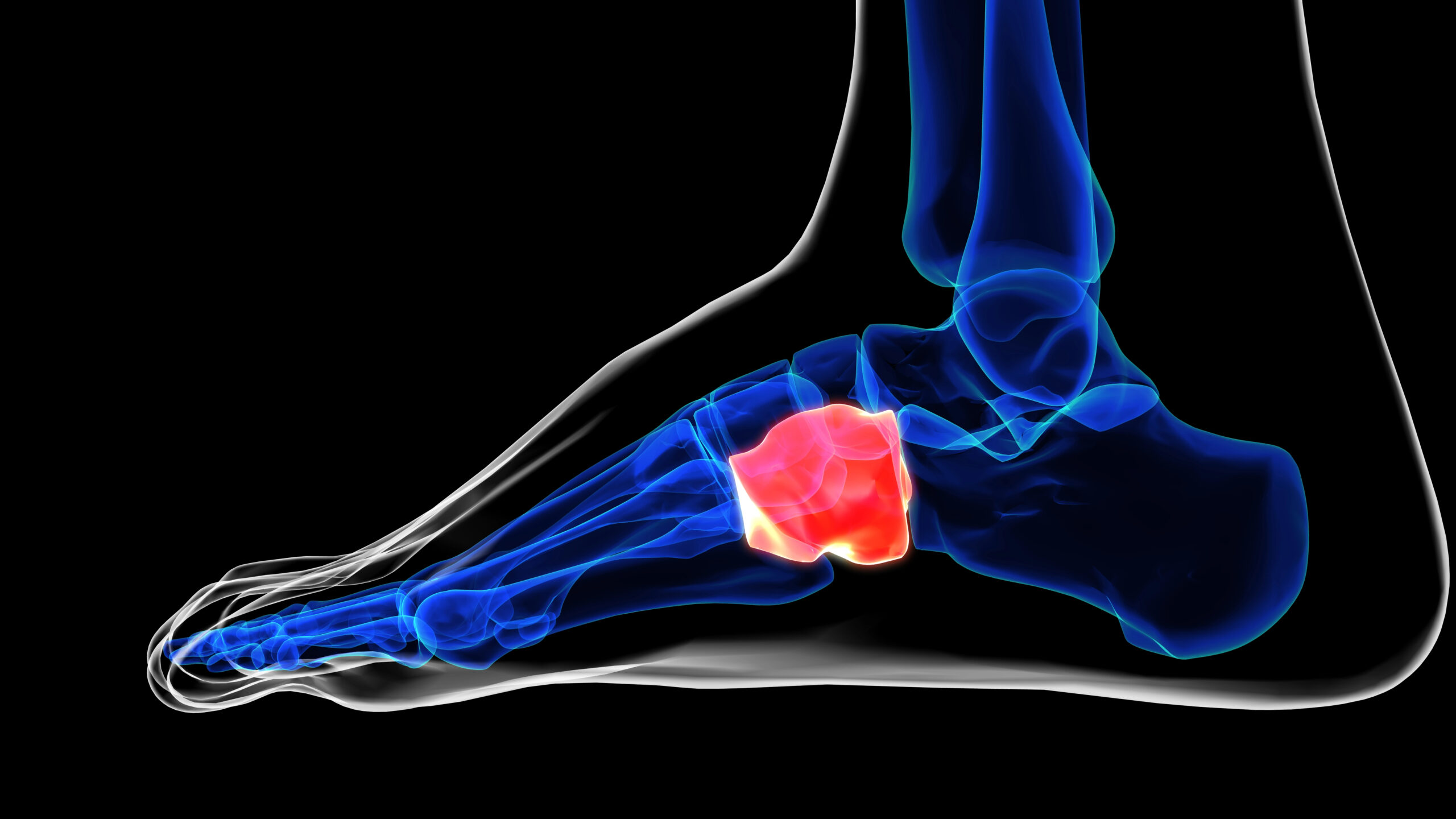 Anatomía del seno del tarso — espacio anterolateral entre astrágalo y calcáneo en Clínica San Román Alicante