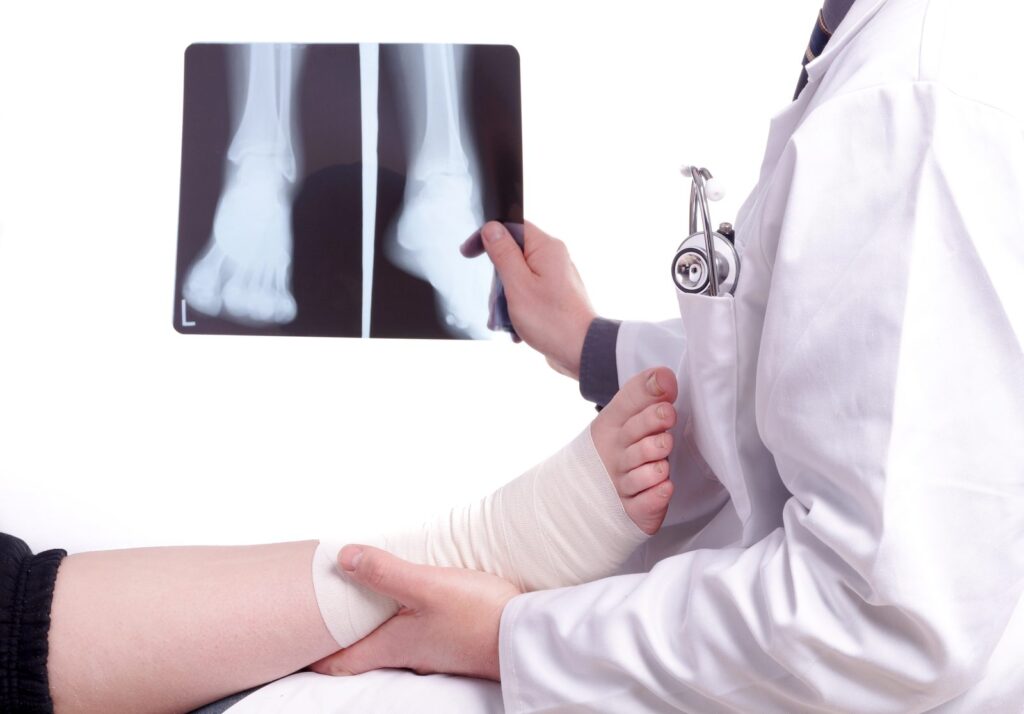 Médico revisando la radiografía de un pie previamente intervenido de hallux valgus